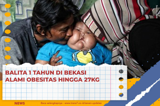 Balita 1 Tahun Di Bekasi Alami Obesitas Hingga 27kg