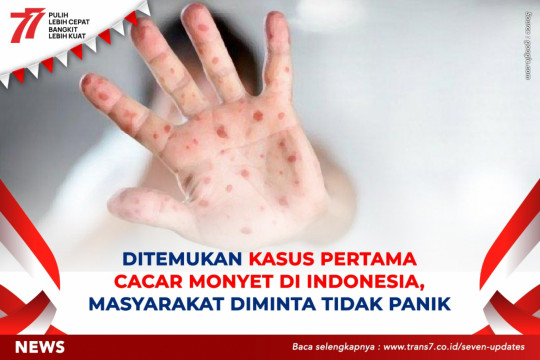 Ditemukan Kasus Pertama Cacar Monyet Di Indonesia, Masyarakat Diminta Tidak Panik