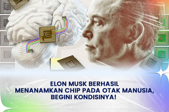 Elon Musk Berhasil Menanamkan Chip Pada Otak Manusia, Begini Kondisinya!