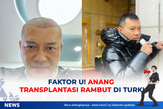 Faktor U! Anang Transplantasi Rambut Di Turki