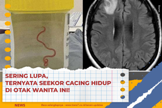 Sering Lupa, Ternyata Seekor Cacing Hidup Di Otak Wanita Ini!